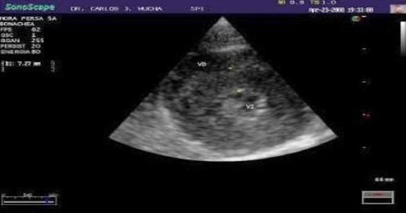 Tromboembolismo arterial felino - Image 1