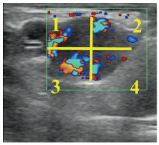 Figura 2. Cuerpo lúteo dividido en cuadrantes para la evaluación de la perfusión sanguínea.