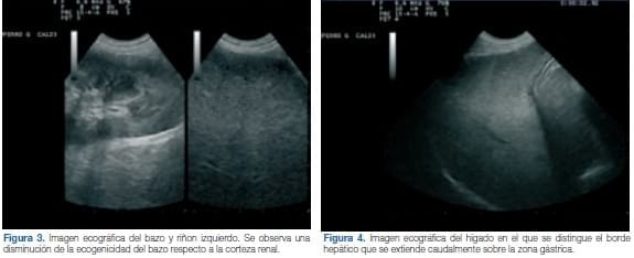 Tratamiento del mastocitoma canino con un inhibidor de la tirosina quinasa. A propósito de un caso clínico - Image 6
