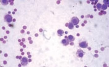 Tratamiento del mastocitoma canino con un inhibidor de la tirosina quinasa. A propósito de un caso clínico - Image 4