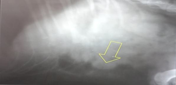 Estenosis hipertrófica pilórica – piloroespasmo. Reporte de un caso - Image 1