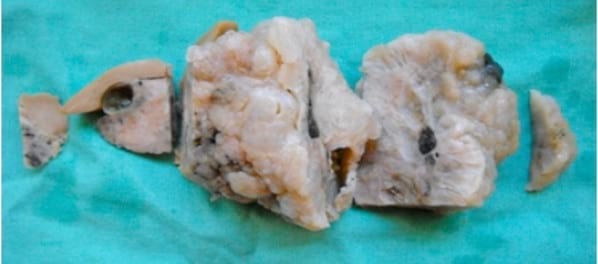 Caso Clínico: Colangioma hepatobiliar en un gato. - Image 3