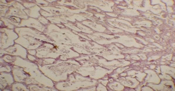 Caso Clínico: Colangioma hepatobiliar en un gato. - Image 4