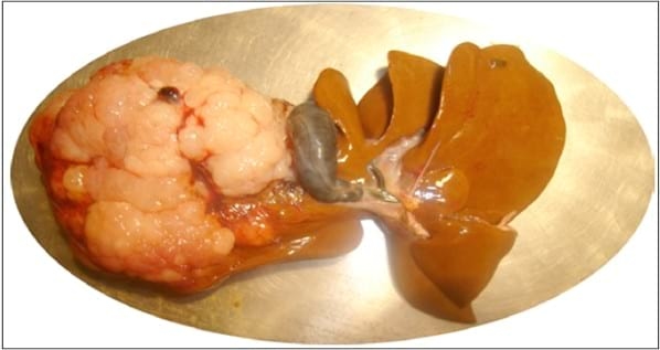 Caso Clínico: Colangioma hepatobiliar en un gato. - Image 2