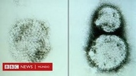 Hantavirus - Image 1