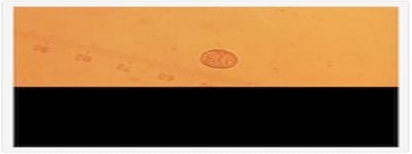 Dinámica de la Excreción de Ooquistes de Cystoisospora grupo ohioensis en Cachorros de Perro Naturalmente Infectados, Concomitantemente Afectados por Toxocara canis y/o Ancylostoma Canis. - Image 1