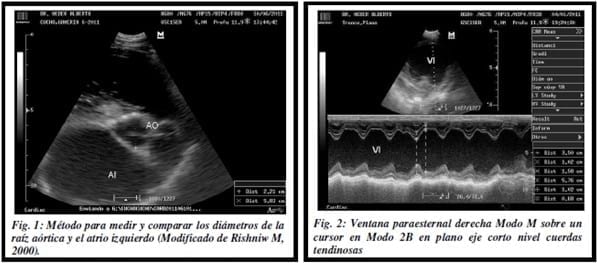 Asociación entre la relación Ao/AI - Ao/VID en caninos con valvulopatía mitral adquirida. - Image 1