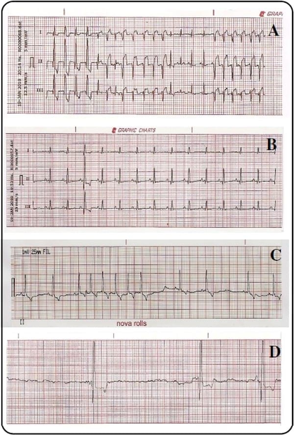 Utilidad de la electrocardiografía en la clínica veterinaria de animales de compañía - Image 2