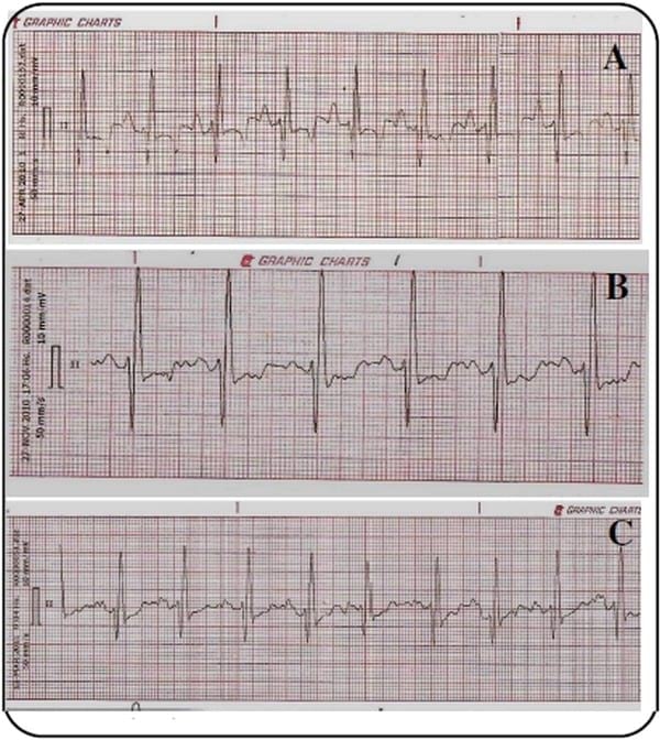 Utilidad de la electrocardiografía en la clínica veterinaria de animales de compañía - Image 4