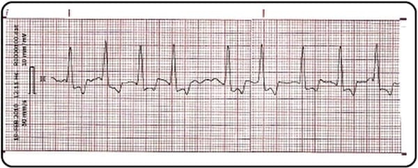 Utilidad de la electrocardiografía en la clínica veterinaria de animales de compañía - Image 1