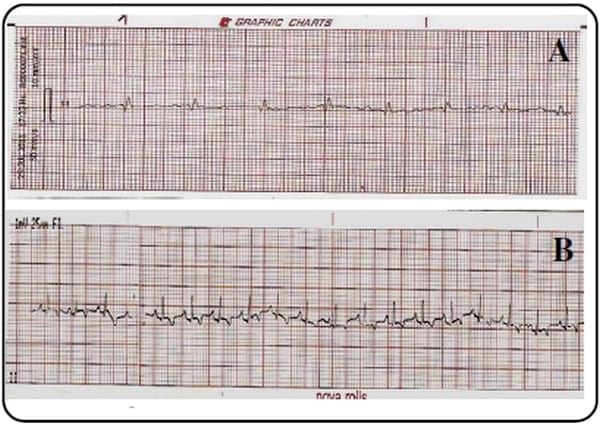 Utilidad de la electrocardiografía en la clínica veterinaria de animales de compañía - Image 7