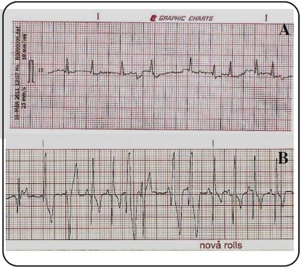 Utilidad de la electrocardiografía en la clínica veterinaria de animales de compañía - Image 6