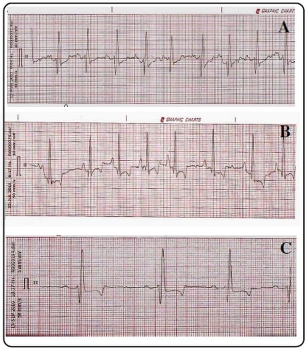 Utilidad de la electrocardiografía en la clínica veterinaria de animales de compañía - Image 3