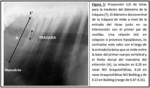Parámetros Objetivos en la Evaluación Radiológico del Aparato Cardiovascular - Image 4