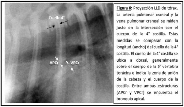 Parámetros Objetivos en la Evaluación Radiológico del Aparato Cardiovascular - Image 5