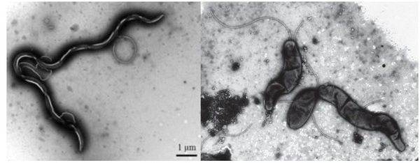 Brachyspira y Lawsonia: Síntomas similares, patógenos diferentes - Image 1