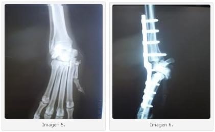 Utilización de Placa Híbrida vs Placa Escalonada en Artrodesis Pancarpiana en Perros. - Image 3