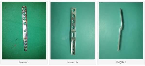 Utilización de Placa Híbrida vs Placa Escalonada en Artrodesis Pancarpiana en Perros. - Image 1