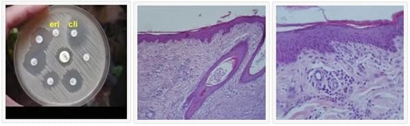 Elaboración de un Protocolo para el Diagnóstico y Tratamiento de Dermatitis Infecciosas Crónicas en Perros. - Image 2