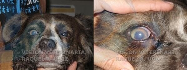 Cirugía del Glaucoma: Gonioimplante - Image 4