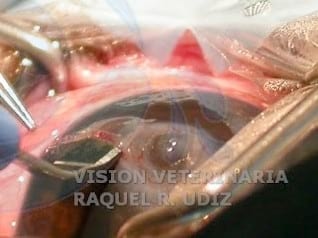 TRASLACIÓN CORNEO CONJUNTIVAL: RESOLVIENDO UN DESCEMATOCELE - Image 1