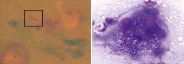 Micobacteriosis en gatos - Image 3