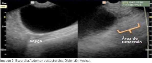 Caso Clínico: Retención urinaria por leiomioma Uterino en una perra. - Image 2