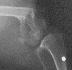 Fracturas supracondilares de fémur - Image 1