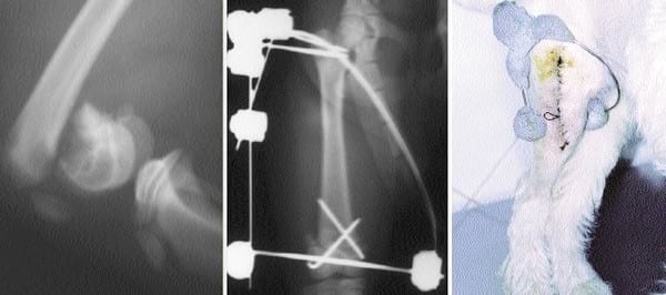 Fracturas supracondilares de fémur - Image 6