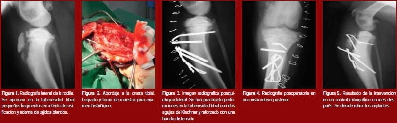 Enfermedad de Osgood-Schlatter en caninos - Image 2