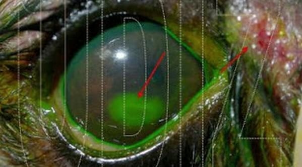 Traumatismo Ocular y Cuerpo Extraño - Image 1