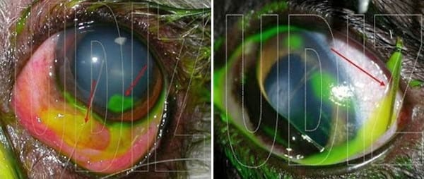 Traumatismo Ocular y Cuerpo Extraño - Image 2