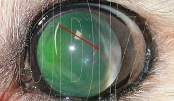 Traumatismo Ocular y Cuerpo Extraño - Image 6
