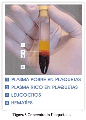 Tendinopatías del tendón flexor digital superficial: diagnóstico y tratamientos - Image 8