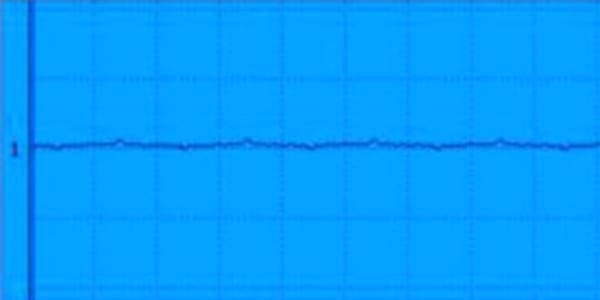 EVALUACION DE LA FUNCION NEUROMUSCULAR: ELECTRONEUROMIOGRAFIA - Image 3