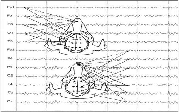 EVALUACION DE LA FUNCION CEREBRAL: ELECTROENCEFALOGRAFIA CLINICA EN PEQUEÑOS ANIMALES - Image 1