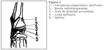 REFORZANDO EL CONCEPTO DE ESCORBUTO - Image 4
