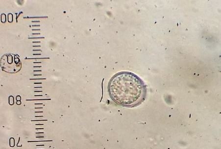 Relevamiento coproparasitario en criaderos familiares de cerdos en Uruguay - Image 19