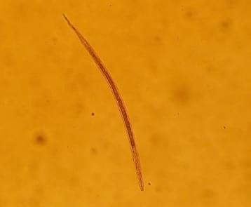 Relevamiento coproparasitario en criaderos familiares de cerdos en Uruguay - Image 22