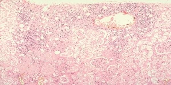 ACTUALIZACIÓN SOBRE PERITONITIS INFECCIOSA FELINA(PIF) Y DESCRIPCIÓN DE UN CASO DE PIF EFUSIVA - Image 8