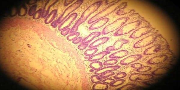 Enterocolitis linfoplasmocitaria con pérdida de proteínas en un Schnauzer mini de 10 meses de edad - Image 2