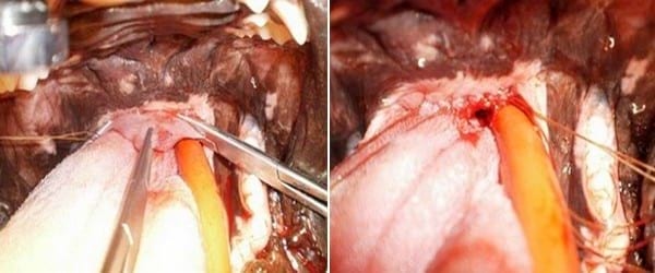 Palatoplastia modificada como tratamiento del síndrome braquiocefálico - Image 4