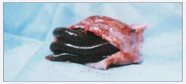 Asociación entre infecciones naturalmente adquiridas de Dirofilaria immitis y Dioctophyma renale en perros de la Zona Norte del Gran Buenos Aires - Image 5
