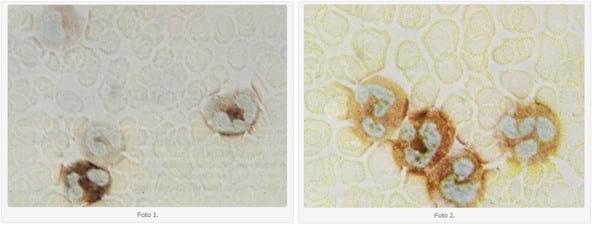 Leucemia mieloide crónica en pacientes caninos: rasgos epidemiológicos y aproximación diagnóstica - Image 4