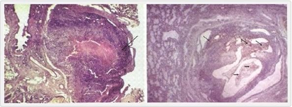 Dirofilaria Immitis y Wolbachia: Implicancias Terapéuticas para la Filariosis Cardiopulmonar - Image 3