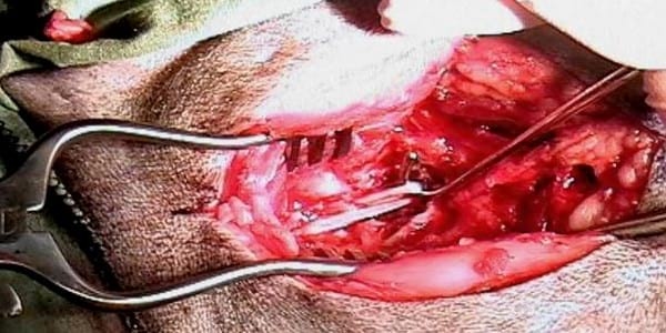 ESTENOSIS DEGENERATIVA LUMBOSACRA (EDL) - Enfermedad Lumbosacra - Image 4