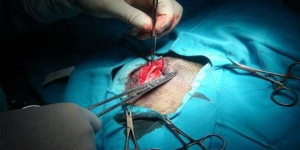 ASPECTOS BASICOS DE LA BIOPSIA DEL NERVIO PERONEAL COMUN - Image 2