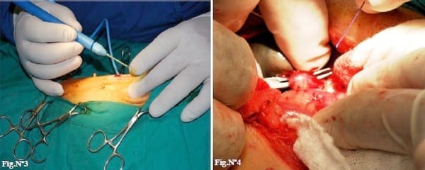 Caso Clínico: Mucocele de vesícula biliar en un perro. - Image 2