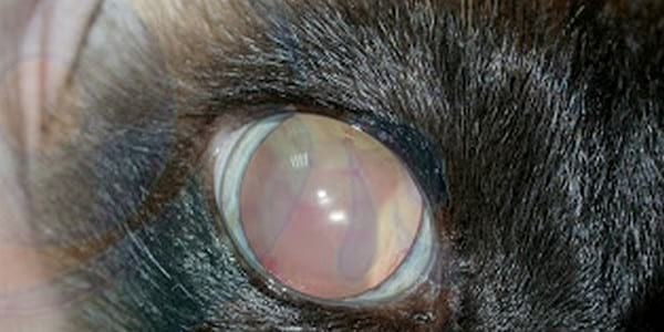 HIPERTENSIÓN SISTÉMICA Y AFECCIÓN OCULAR - Image 3