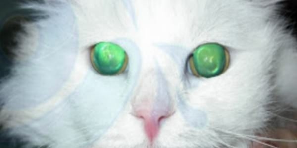 HIPERTENSIÓN SISTÉMICA Y AFECCIÓN OCULAR - Image 2